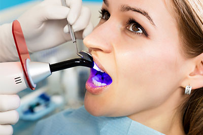 El Cajon Dentistry | Digital Impressions, Dental Fillings and Cosmetic Dentistry