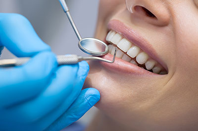 El Cajon Dentistry | Sports Mouthguards, Snoring Appliances and Dental Lab