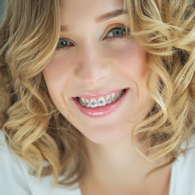 El Cajon Dentistry | ClearCorrect reg , Sedation Dentistry and Night Guards