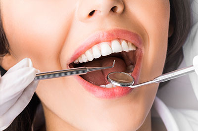 El Cajon Dentistry | Dental Fillings, All-on-6 and Invisalign reg 