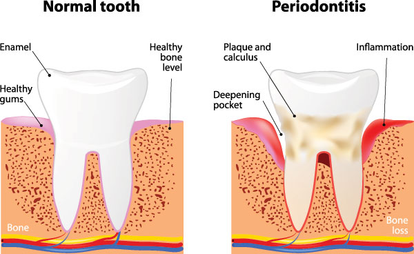 El Cajon Dentistry | Digital Radiography, Root Canals and Dental Cleanings