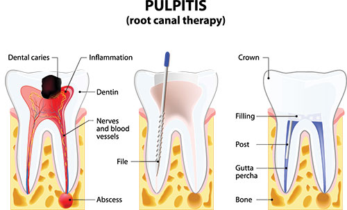 El Cajon Dentistry | Snoring Appliances, Oral Exams and Oral Cancer Screening