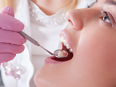El Cajon Dentistry | Sports Mouthguards, Sedation Dentistry and Dental Fillings